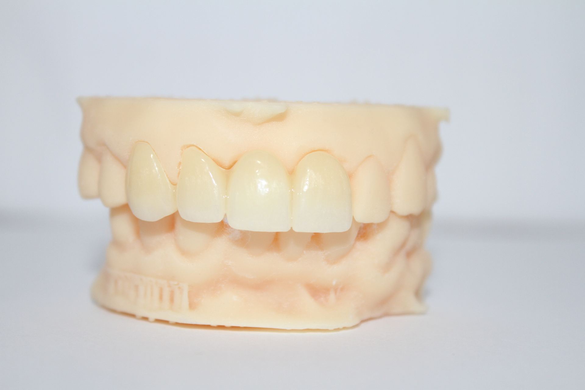 Tratamiento dental en Oral Dent